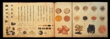 三天完成14例中医穴位埋线:肝癌术后、抑郁症等多样化案例分享